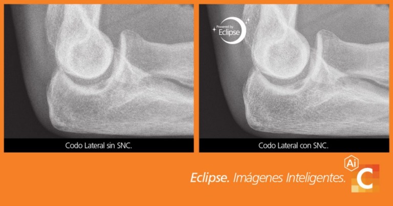 Carestream lanza nuevas soluciones de radiología en el evento más importante del sector.