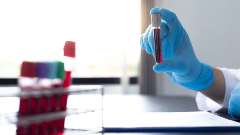 Japón autoriza prueba sanguínea para detectar el Alzheimer