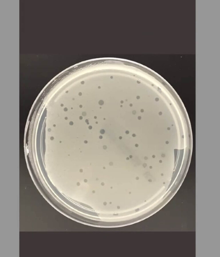 Con virus “depredadores” buscan combatirbacterias resistentes a los antibióticos