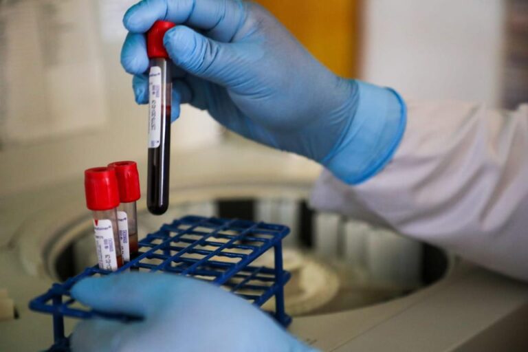 En apoyo a la economía familiar, el DIF Tlalnepantla ofrece servicio de laboratorio a bajo costo