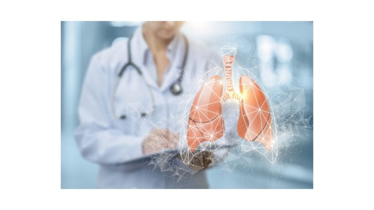 Atención de comorbilidades mejora el pronóstico de vida en pacientes con Fibrosis Pulmonar