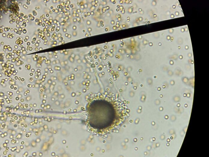 4Micotoxinas en alimentos es una amenaza invisible para la salud