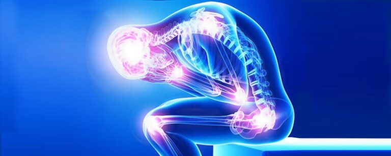 Innovación científica de UCB dentro de la reumatología en México