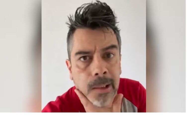 Carlos Espejel aparece con parálisis facial; atribuye su estado al estrés