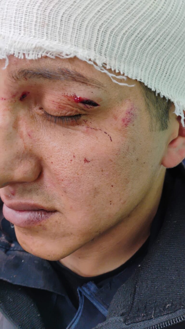 Policías y patrullas fueron agredidos durante intervención en plantel de Conalep Huixquilucan